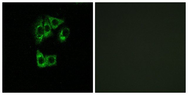 Anti-GIMAP2 antibody produced in rabbit