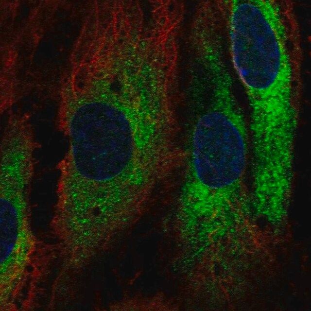 Anti-GIMAP1 antibody produced in rabbit