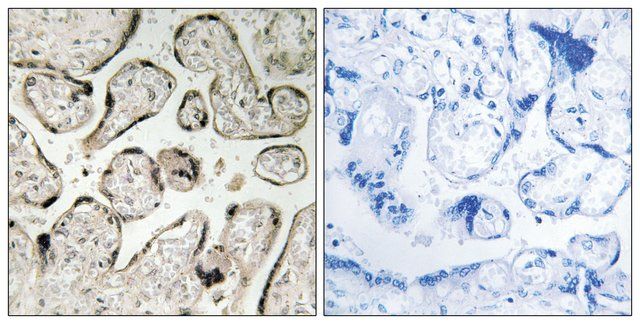 Anti-GIMAP5 antibody produced in rabbit