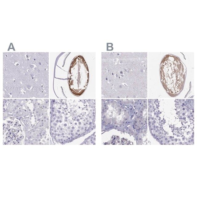 Anti-GJA8 antibody produced in rabbit