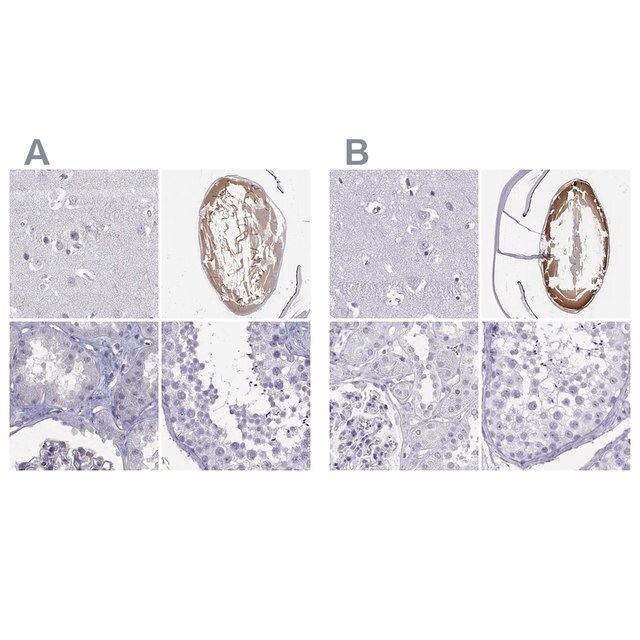 Anti-GJA8 antibody produced in rabbit