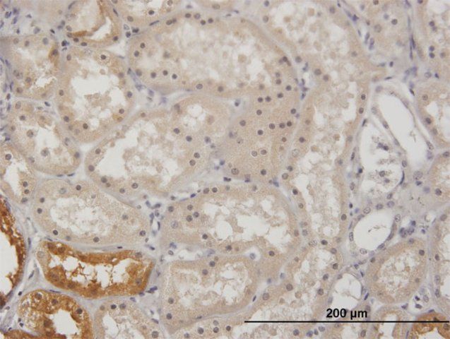 Anti-GK antibody produced in mouse