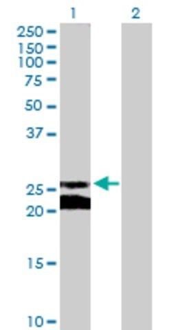 Anti-GJB5 antibody produced in mouse