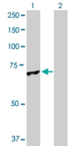 Anti-GLMN antibody produced in rabbit