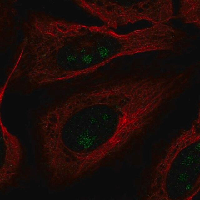 Anti-FOXL2NB antibody produced in rabbit