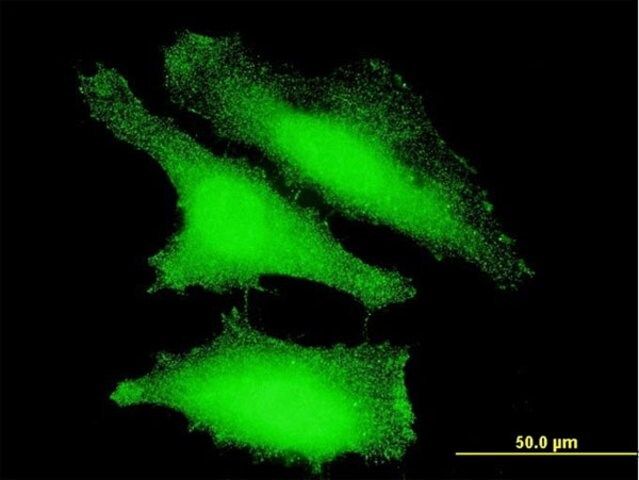 ANTI-FOXO1A antibody produced in mouse