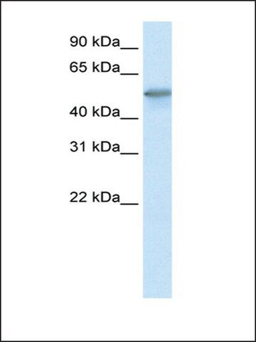 Anti-FoxO3a antibody produced in rabbit