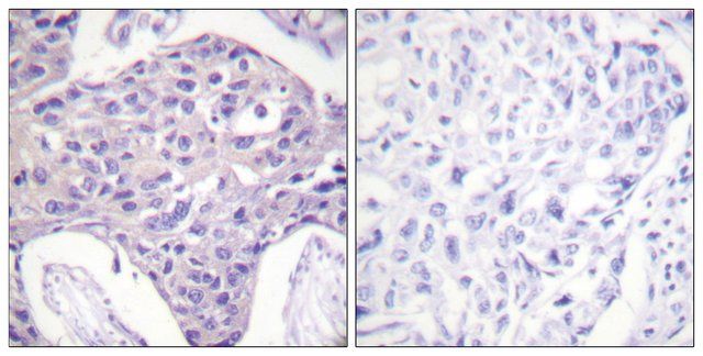 Anti-FOXO1 antibody produced in rabbit