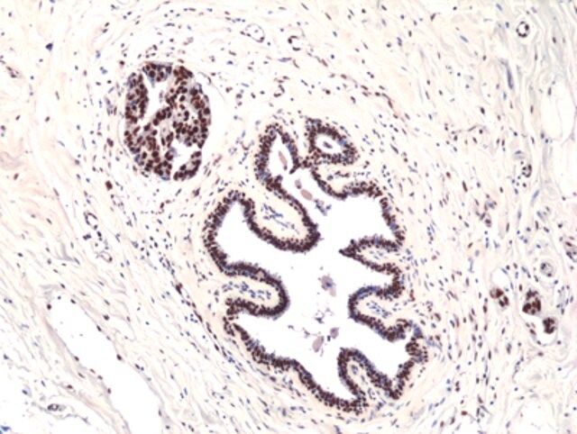 Anti-Foxp1 Rabbit Monoclonal Antibody