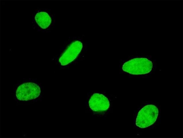 ANTI-FOXQ1 antibody produced in mouse