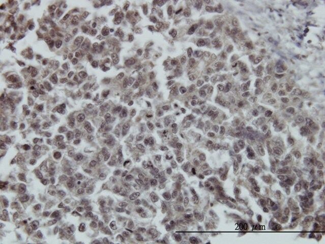 ANTI-FOXO3A antibody produced in mouse