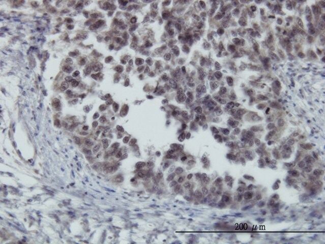 ANTI-FOXO3A antibody produced in mouse