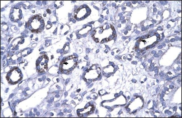 Anti-FOXP1 antibody produced in rabbit