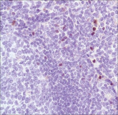 Anti-FOXP3 antibody, Rabbit monoclonal