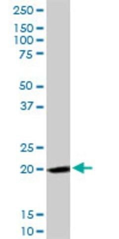 Anti-FTH1 antibody produced in rabbit