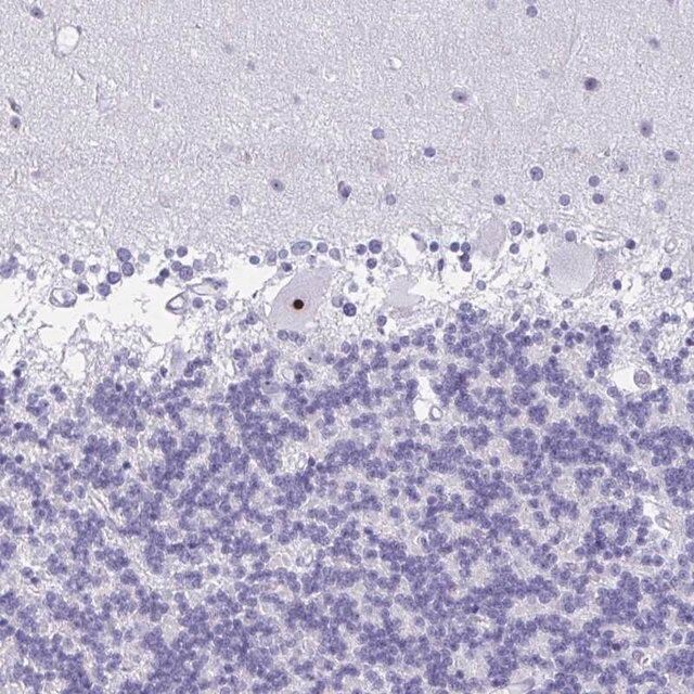 Anti-FTSJ3 antibody produced in rabbit