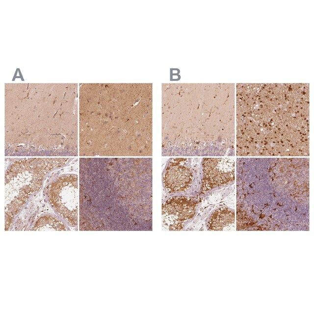 Anti-FSCN1 antibody produced in rabbit