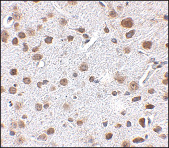 Anti-FTO antibody produced in rabbit