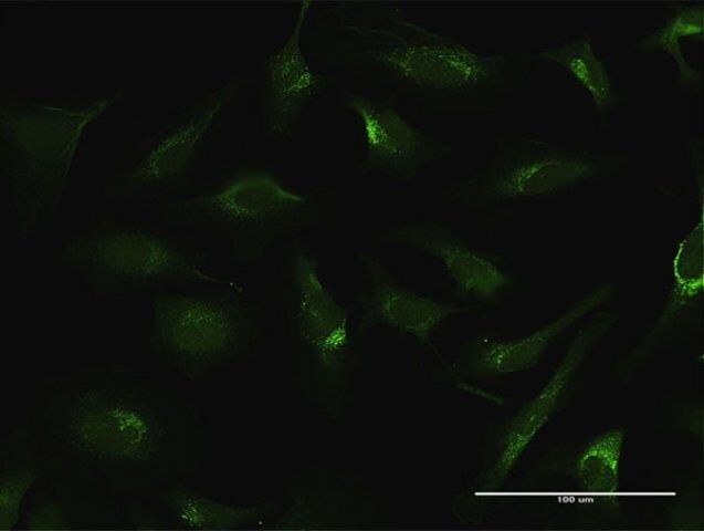 Anti-FTL antibody produced in rabbit