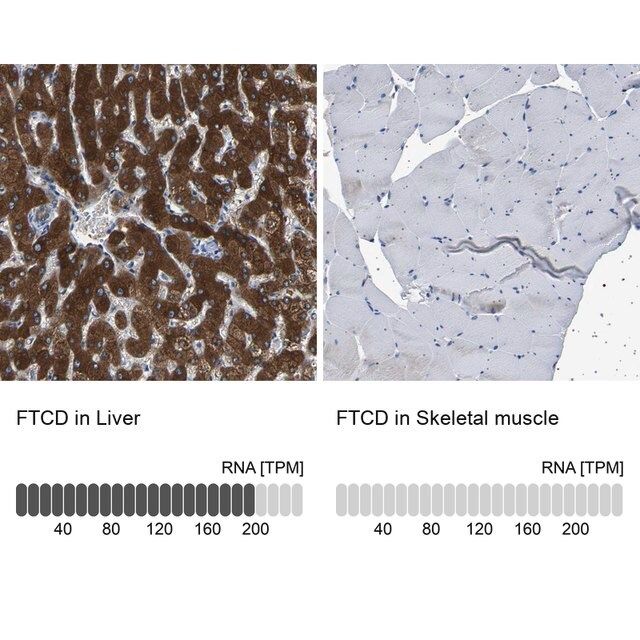 Anti-FTCD antibody produced in rabbit