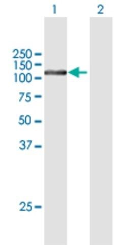 Anti-FTSJD2 antibody produced in mouse