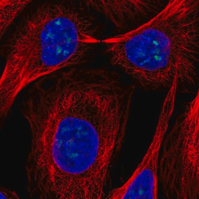 Anti-FTSJ3 antibody produced in rabbit