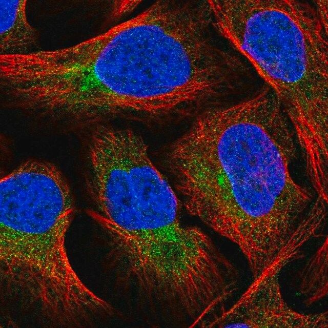 Anti-FUT8 antibody produced in rabbit