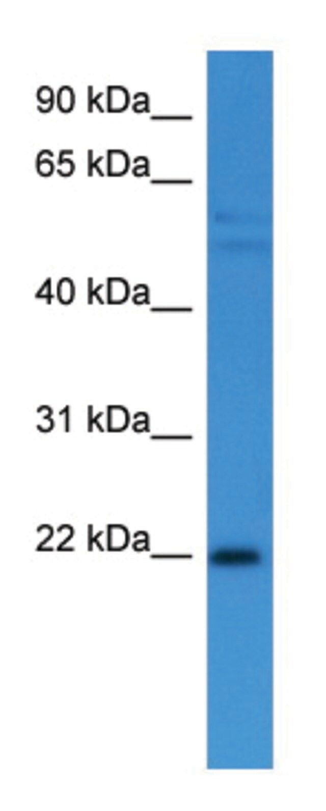 Anti-GADD45A (C-terminal) antibody produced in rabbit