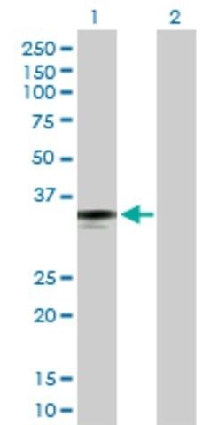 Anti-FCN2 antibody produced in rabbit