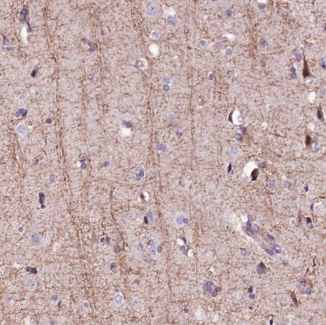 Anti-FCHSD2 antibody produced in rabbit