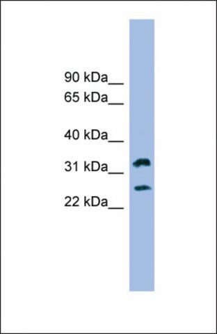 Anti-FCER1A, (N-terminal) antibody produced in rabbit