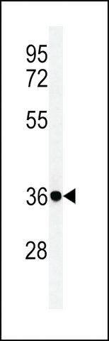 ANTI-FCGR1A (CENTER) antibody produced in rabbit