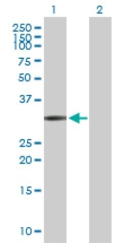 Anti-FCN1 antibody produced in rabbit