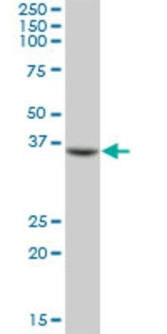 Anti-FCRLM2 antibody produced in mouse