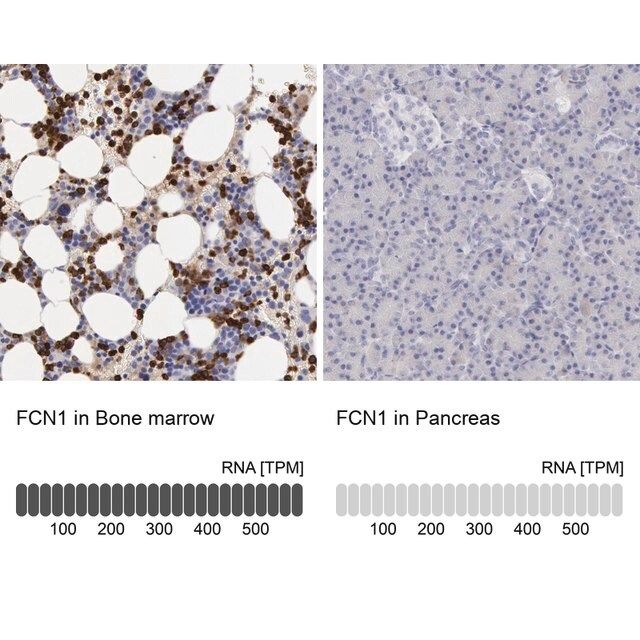 Anti-FCN1 antibody produced in rabbit