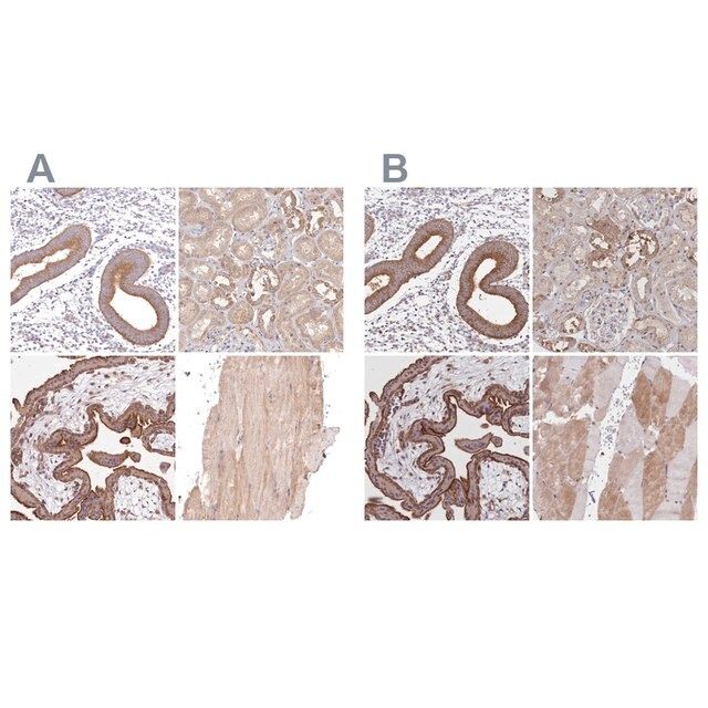 Anti-FCHO2 antibody produced in rabbit