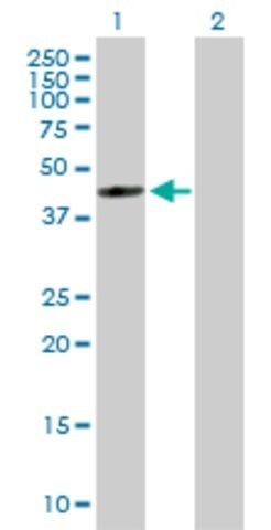 Anti-FDFT1 antibody produced in mouse