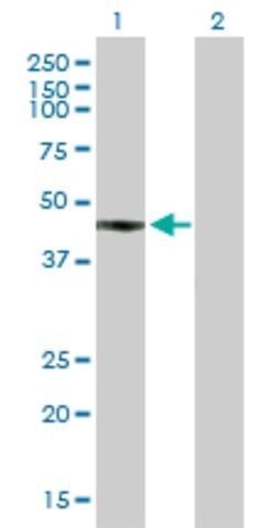 Anti-FCRLA antibody produced in mouse