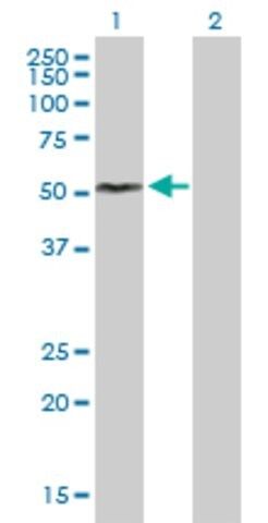 Anti-FCRL1 antibody produced in mouse