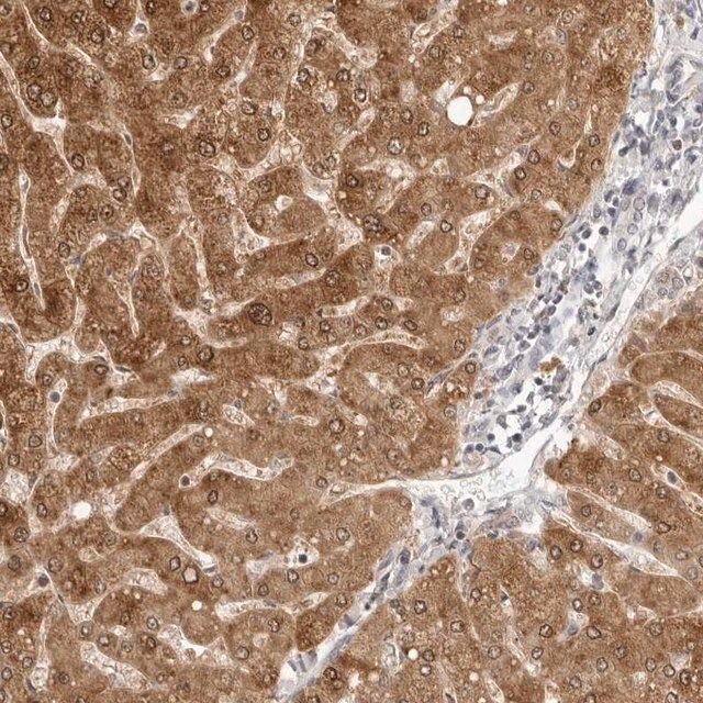 Anti-FDPS antibody produced in rabbit