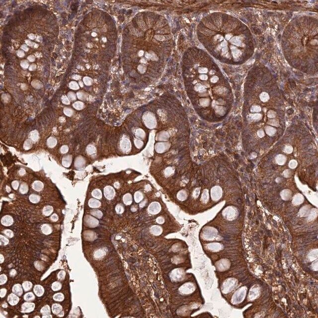 Anti-FCHSD1 antibody produced in rabbit