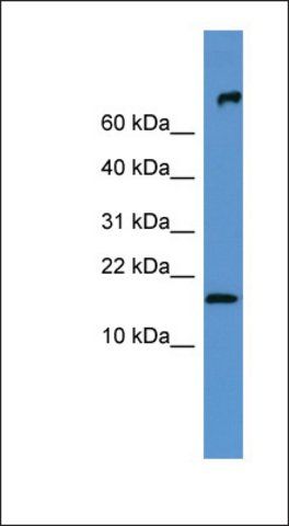 Anti-FGF1 antibody produced in rabbit