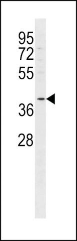 ANTI-FFAR2(C-TERMINAL) antibody produced in rabbit