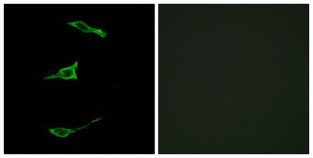 Anti-FFAR1 antibody produced in rabbit