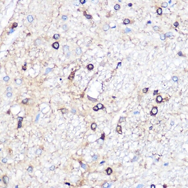 Anti-Ferritin Light Chain antibody produced in rabbit