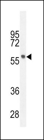 ANTI-FEZF1 (N-TERM) antibody produced in rabbit