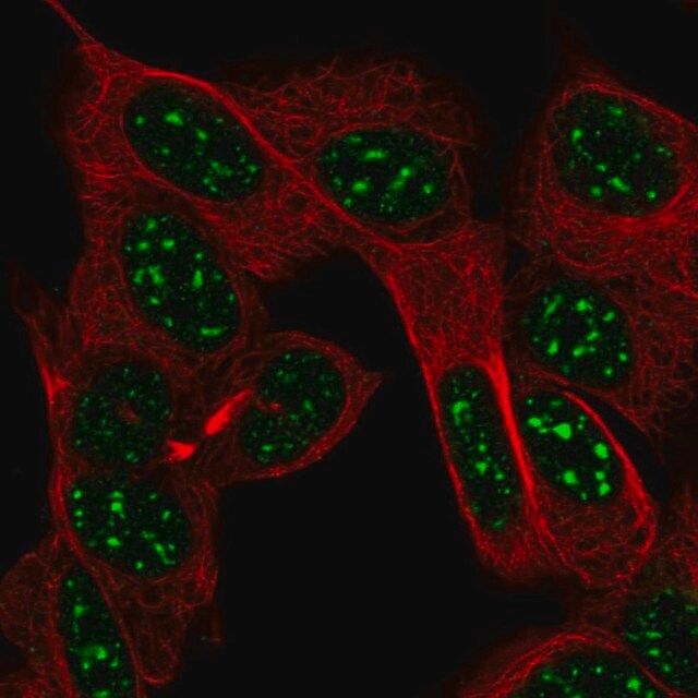 Anti-FEV antibody produced in rabbit