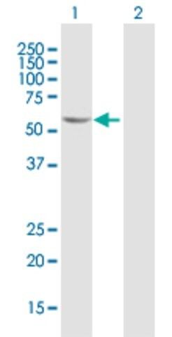 Anti-FGD5 antibody produced in mouse