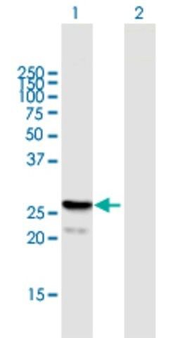 Anti-FGF21 antibody produced in mouse