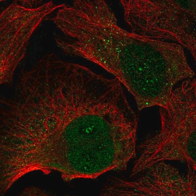 Anti-FGF5 antibody produced in rabbit